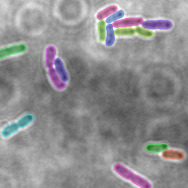 Best agent run (0.544) for a held-out Brightfield bacteria crop