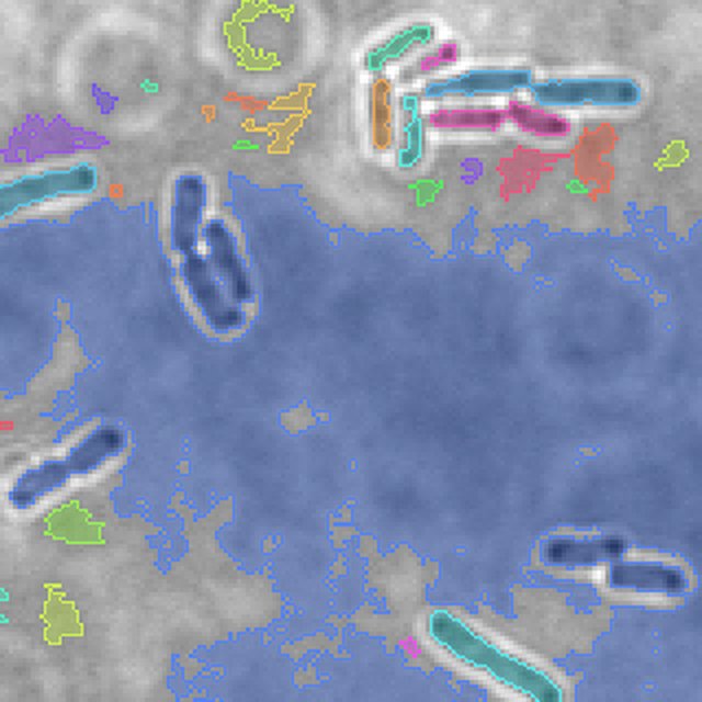 Classical floor (0.141) for a held-out Brightfield bacteria crop
